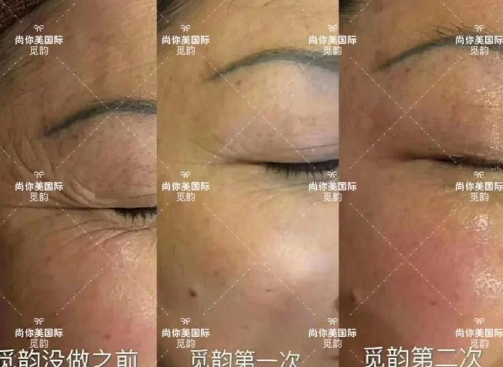 美白面膜哪個(gè)牌子的效果好價(jià)格便宜點(diǎn)