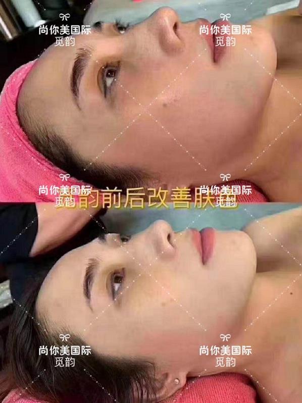 美白面膜哪個(gè)牌子的效果好價(jià)格便宜點(diǎn) 美白面膜哪個(gè)牌子的效果好價(jià)格便宜點(diǎn)