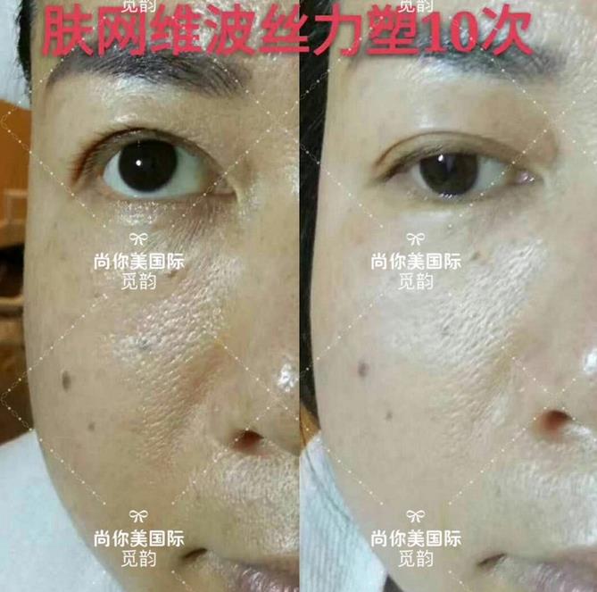 美白面膜哪個(gè)牌子的效果好價(jià)格便宜點(diǎn) 美白面膜哪個(gè)牌子的效果好價(jià)格便宜點(diǎn)