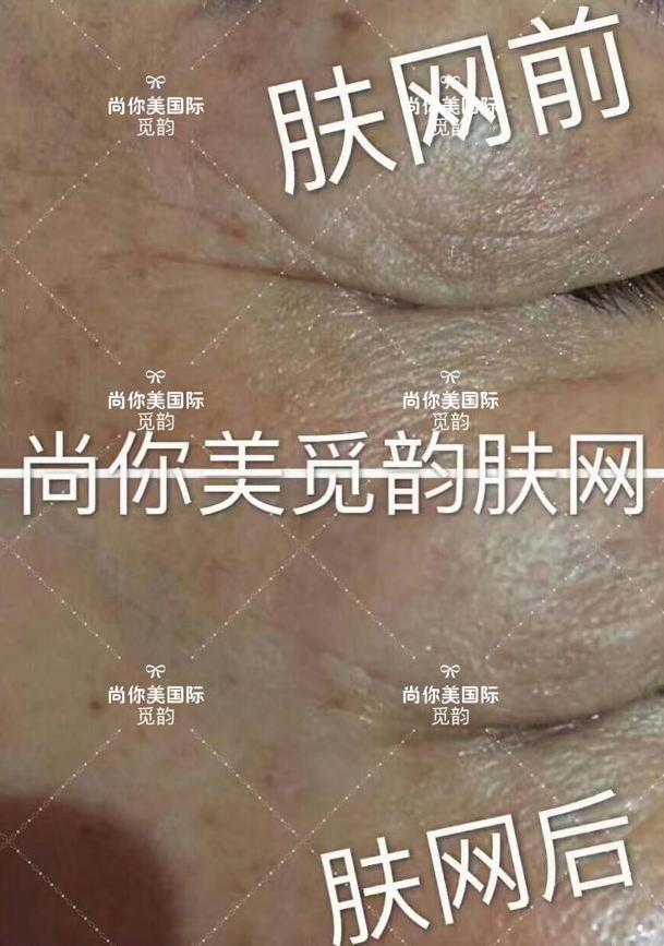 美白面膜哪個(gè)牌子的效果好價(jià)格便宜點(diǎn) 美白面膜哪個(gè)牌子的效果好價(jià)格便宜點(diǎn)