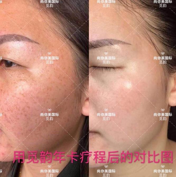 美白面膜哪個(gè)牌子的效果好價(jià)格便宜點(diǎn) 美白面膜哪個(gè)牌子的效果好價(jià)格便宜點(diǎn)