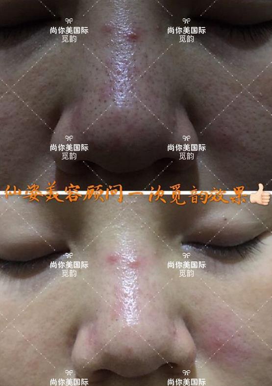 美白面膜哪個(gè)牌子的效果好價(jià)格便宜點(diǎn) 美白面膜哪個(gè)牌子的效果好價(jià)格便宜點(diǎn)