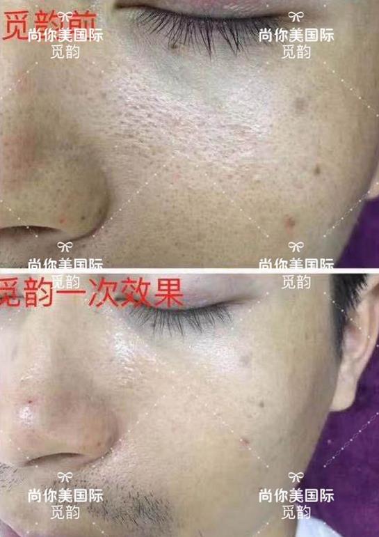 美白面膜哪個(gè)牌子的效果好價(jià)格便宜點(diǎn) 美白面膜哪個(gè)牌子的效果好價(jià)格便宜點(diǎn)