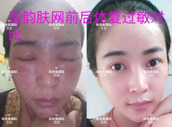 美白面膜哪個(gè)牌子的效果好價(jià)格便宜點(diǎn) 美白面膜哪個(gè)牌子的效果好價(jià)格便宜點(diǎn)