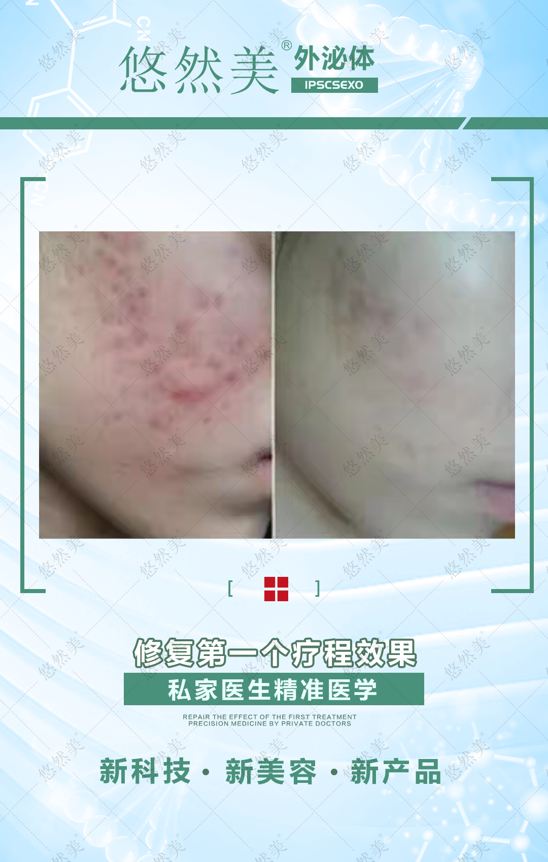 外泌體有什么功效與作用，正規(guī)嗎   來看一下部分案例