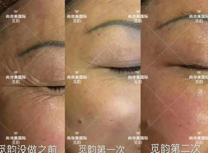 美容院拓客套盒方法，眼部面部身體拓客套盒話術(shù)