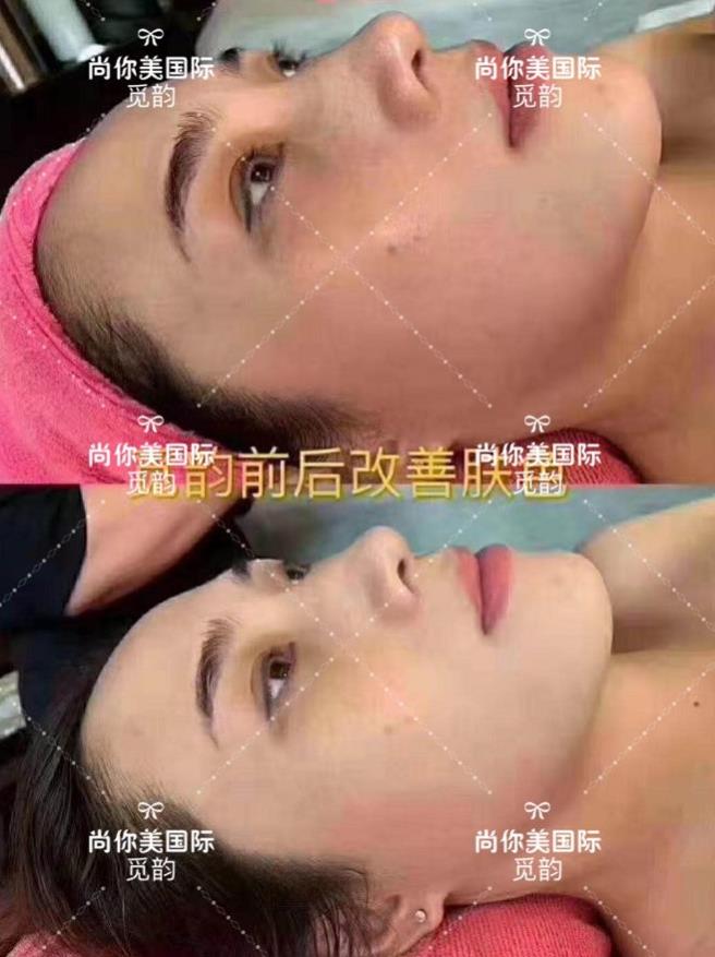 美容院拓客套盒方法，眼部面部身體拓客套盒話術(shù)