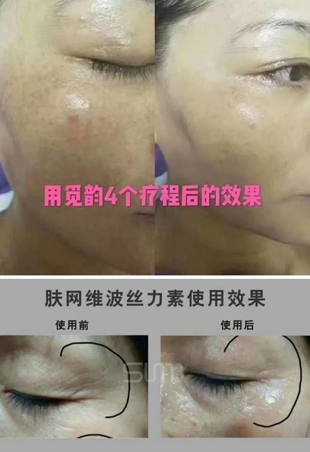 美容院美容產(chǎn)品加盟項目覓韻 美容院美容產(chǎn)品加盟項目覓韻