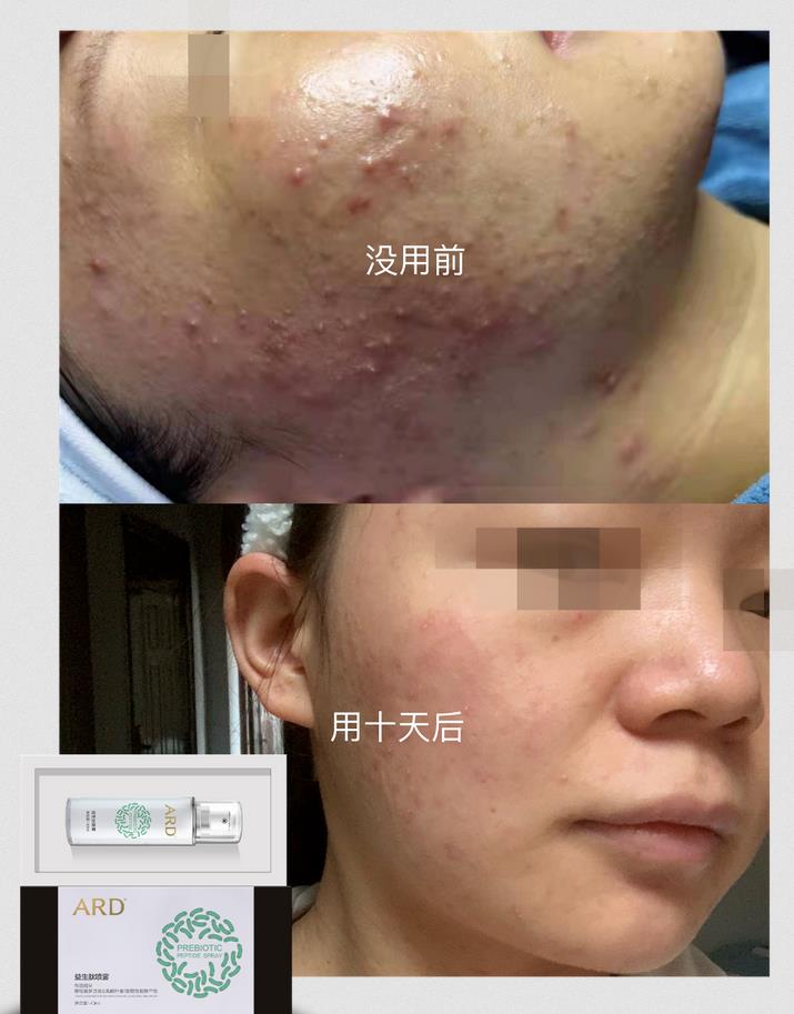 ARD益生肽噴霧 ARD益生肽噴霧