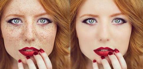 美容院祛斑要多少錢一次