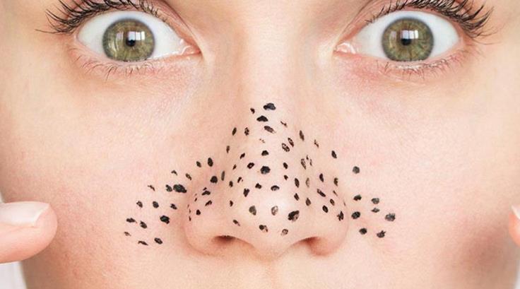  一、美容院去黑頭有效果嗎？美容院去黑頭多少錢一次